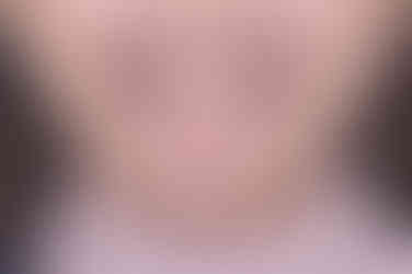 부산사각턱보톡스