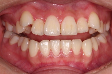 연산동교정치과