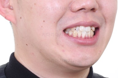 부산인비절라인