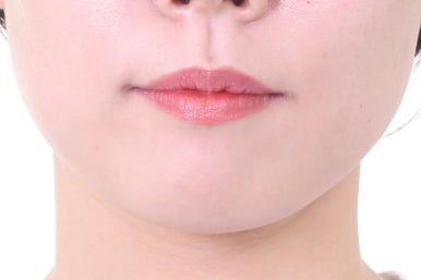 부산연산동교정치과