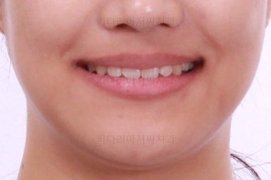 연산동치아교정치과