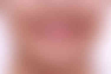 연산동치아교정치과