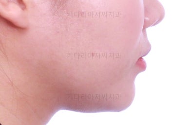 부산치아교정치과