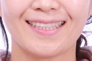 부산인비절라인