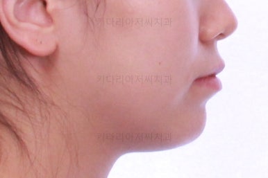 부산교정잘하는치과