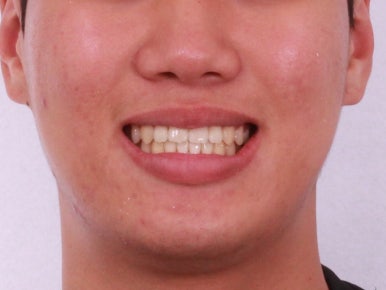 부산교정치과추천