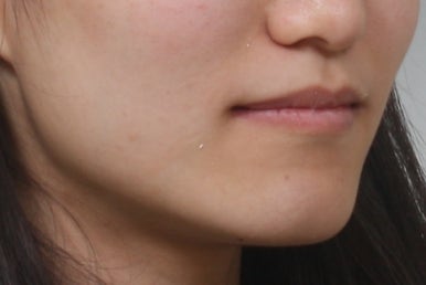 부산교정전문의