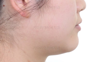 연산동교정치과