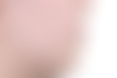 부산덧니교정