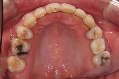 부산재교정치과