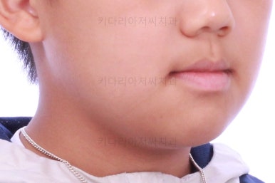부산어린이교정