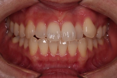 부산인비절라인