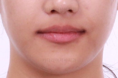 연산동치아교정치과