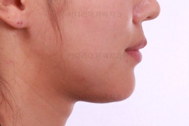 부산치아교정잘하는곳