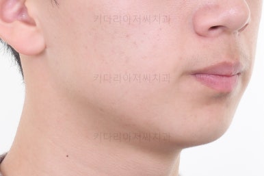 부산청소년치아교정