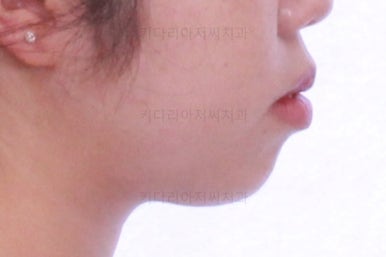 부산교정전문치과