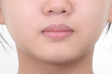 부산교정전문의