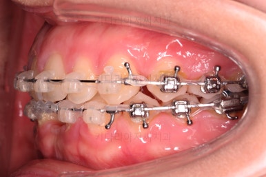 부산교정치과추천