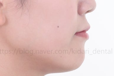 부산인비절라인