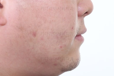 연산동임플란트