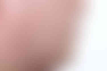 연산동임플란트