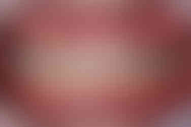 부산매복치아교정