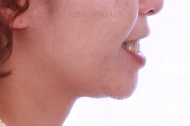부산연산동교정치과