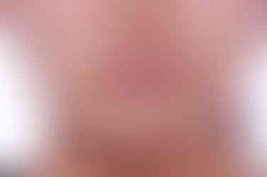 부산비발치교정