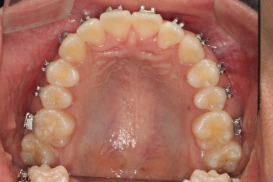 부산연산동청소년교정