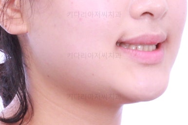 부산교정치과추천