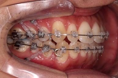 부산연제구교정