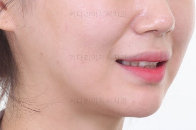 연산동교정치과