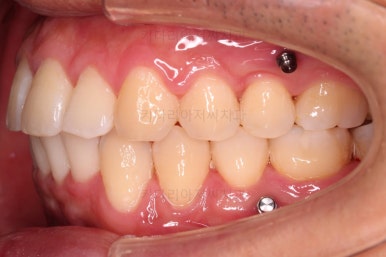 부산교정치과추천