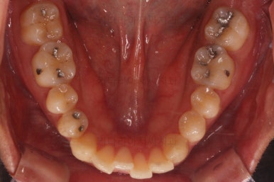 부산연제구교정