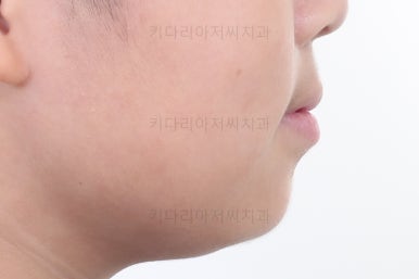 부산어린이교정