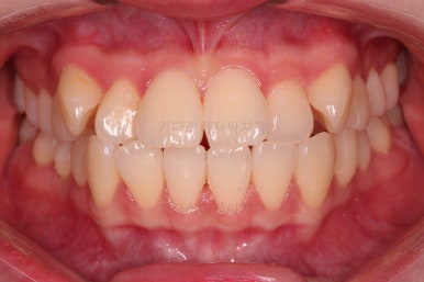 부산교정전문의