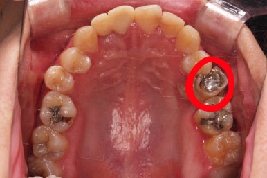 연산동치아교정