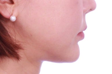 연산동부분교정