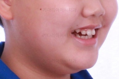 부산교정치과추천