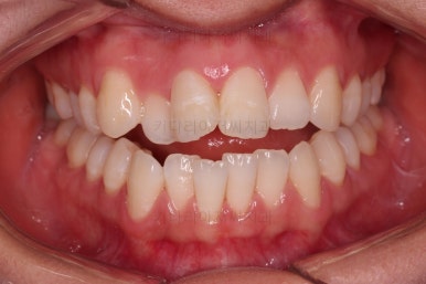 부산교정잘하는치과