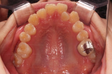 동래구치아교정