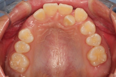 부산연산동청소년교정