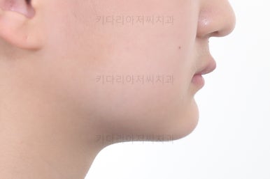 부산청소년교정치과