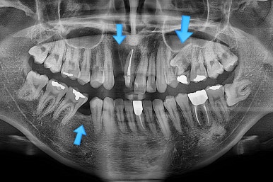 연산동치아교정