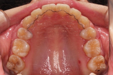 부산연산동교정치과