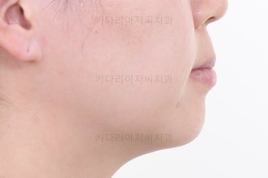 부산연산동치과