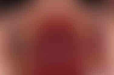 연산동임플란트