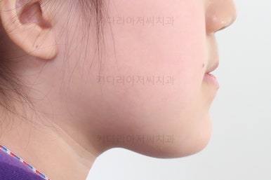 부산초등학생교정