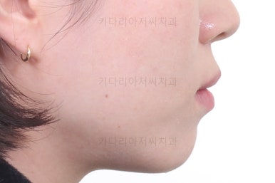 부산치아교정잘하는곳