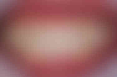 부산주걱턱교정